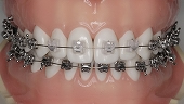 device_ortho_r2_c41