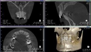 Dental CT sample2